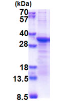 Recombinant Human Proprotein Convertase Subtilisin/Kexin Type 1 Inhibitor